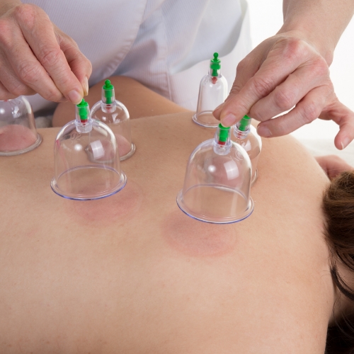 physical-therapy-clinic-cupping-clearcut-ortho-fort-worth-tx